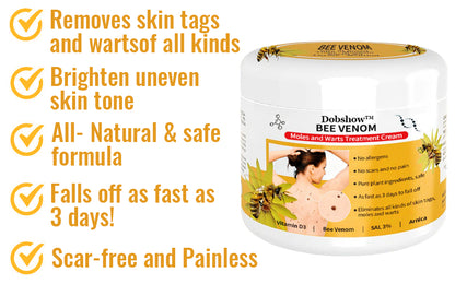 🐝🐝 Dobshow™Bee Venom Mole and Wart Treatment Cream(👨‍⚕AAD RECOMMENDS)