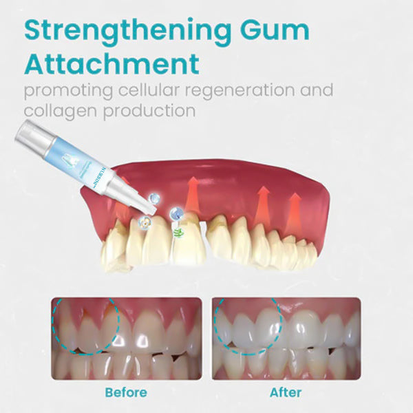 Nurbini™ Gum Shield Therapy Gel (Last Day Promotion 80% OFF🔥)