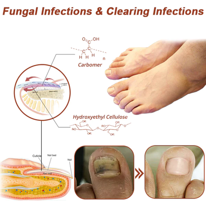 Bloomssss PROMAX Revolutionary High-Efficiency Light Therapy Device For Toenail Diseases