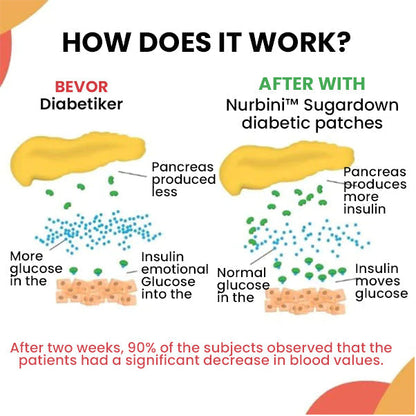 Nurbini™  Sugardown Diabetikerpflaster