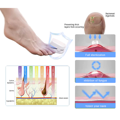 Bloomssss PROMAX Revolutionary High-Efficiency Light Therapy Device For Toenail Diseases