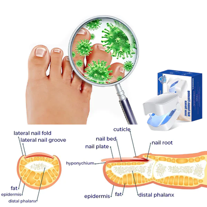 Bloomss™ PROMAX Revolutionary High-Efficiency Light Therapy Device For Toenail Diseases