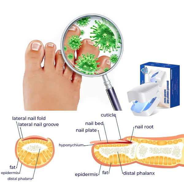 Bloomssss PROMAX Revolutionary High-Efficiency Light Therapy Device For Toenail Diseases