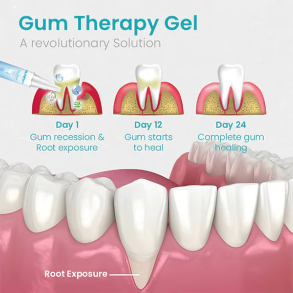 Nurbini™ Gum Shield Therapy Gel (Last Day Promotion 80% OFF🔥)