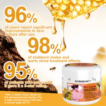 🐝🐝 Dobshow™Bee Venom Mole and Wart Treatment Cream