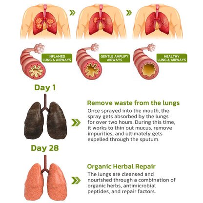 Dobshow™  BreathDetox Herbal Lung Cleansing Spray