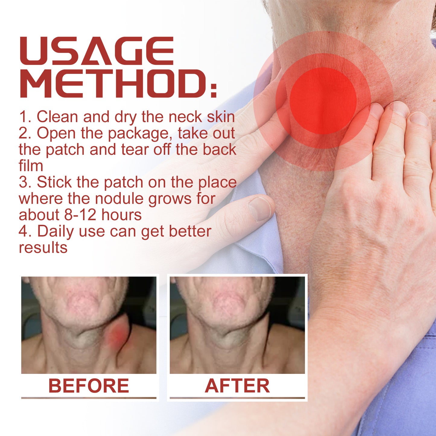 Nurbini™  lymphatic patches - Lymphatic repair, reduce neck and axillary enlargement