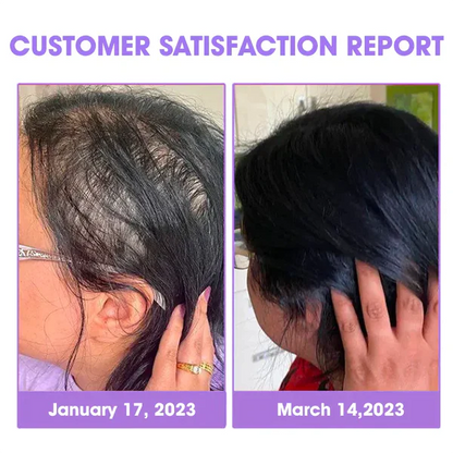 Nurbini™ Hair Follicle Repair Hair Growth Drops - Achieve thicker hair quickly