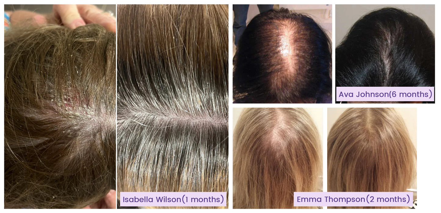 Nurbini™ Hair Follicle Repair Hair Growth Drops - Achieve thicker hair quickly