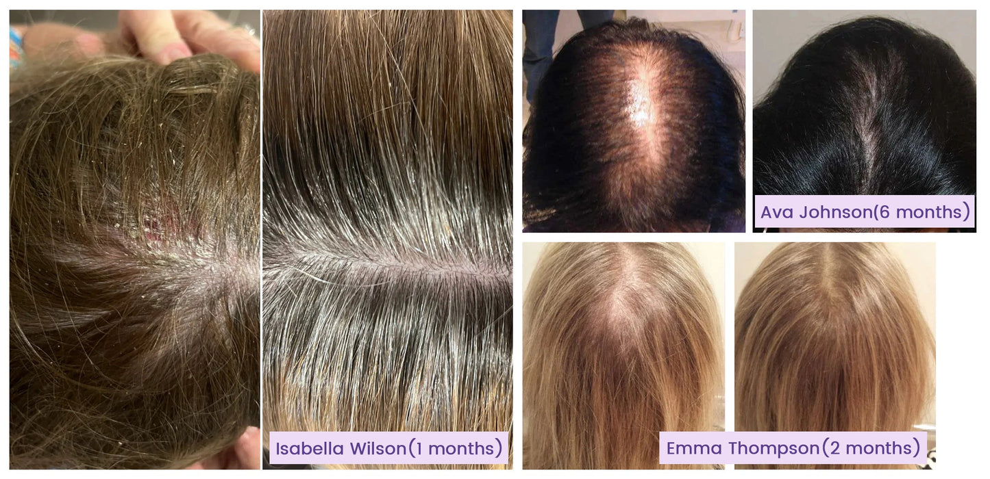 Nurbini™ Hair Follicle Revival Drops: Boost Your Way to Thicker Hair Fast! 💈✨